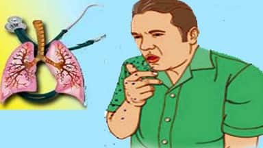 world tuberculosis day today deaths from tb number of tb patients in up tb prevention methods sy 1553409619